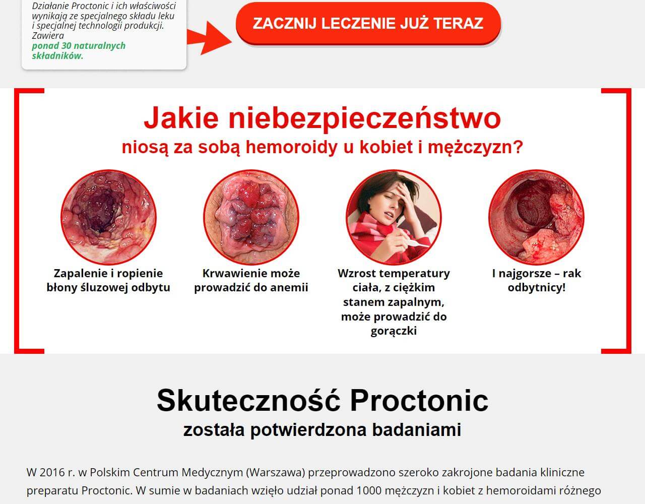 Proctonic 4