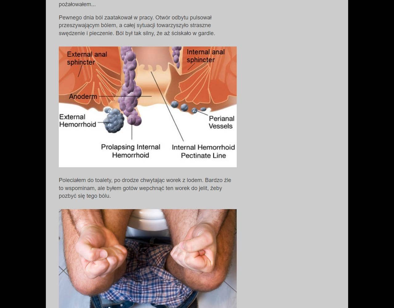 Proctowell 2